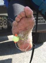 Snake's fish hook injury