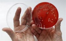 Staph germs on beaches
